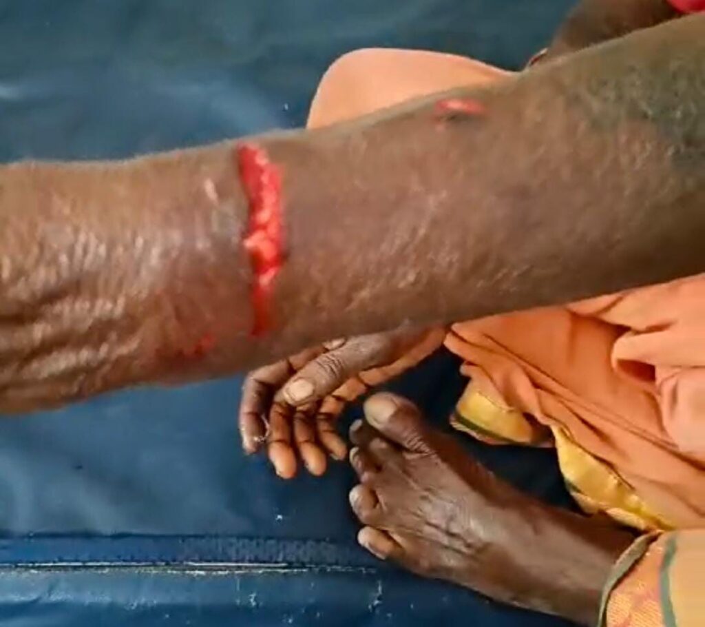 Ten people were bitten by one dog